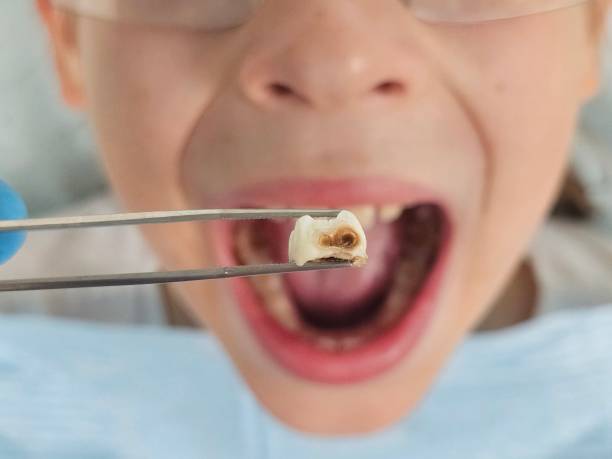 Best Tooth Pain Emergency Relief  in Sun City Center, FL