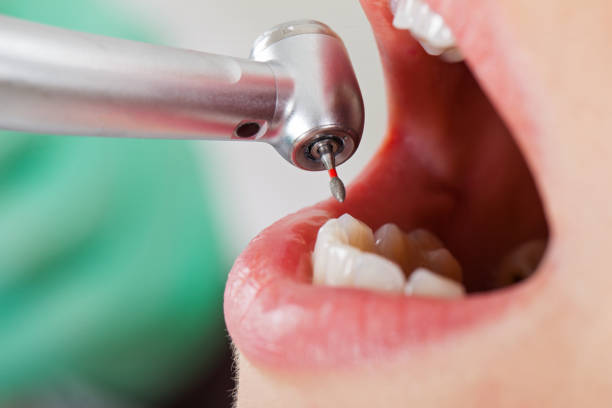 Best Urgent Tooth Repair  in Sun City Center, FL